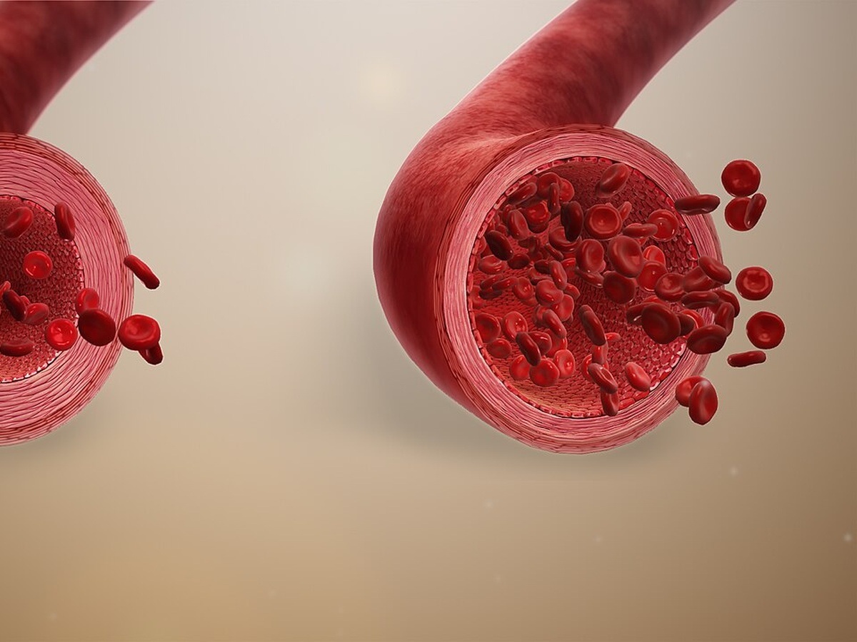 Estimulación vascular