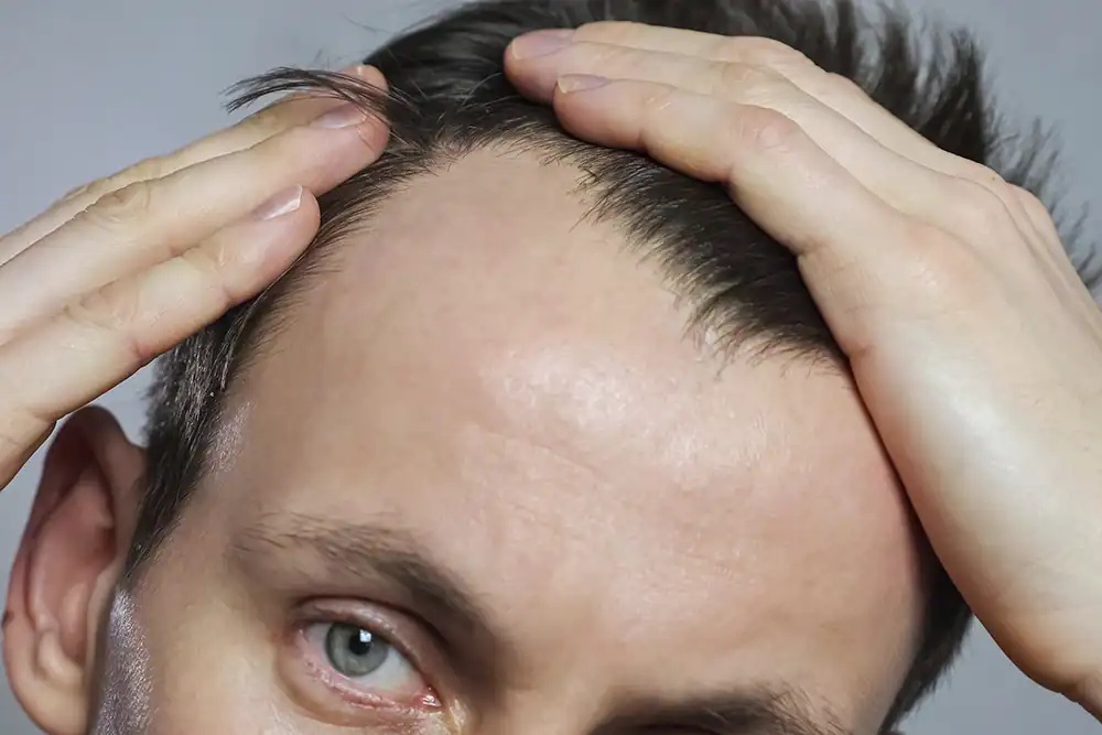 Evaluación clínica de línea frontal y entradas en No Filters Pamplona