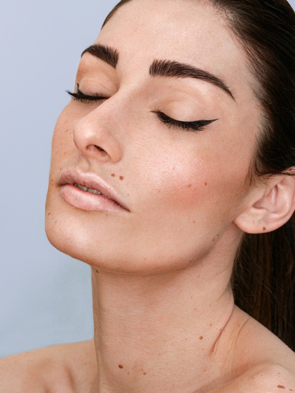 Tratamiento despigmentante de manchas y melasma en Clínicas No Filters