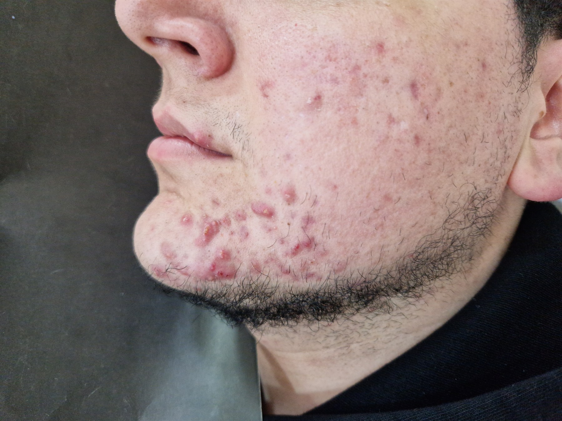 Protocolos de cosmecéutica médica en Pamplona