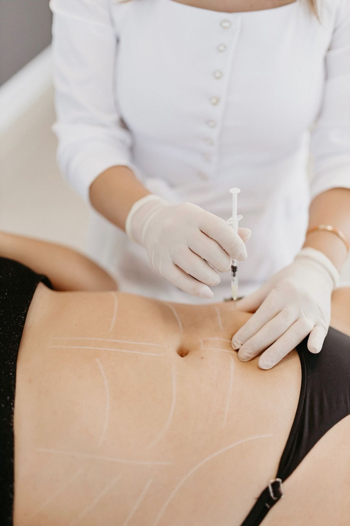 Mesoterapia médica intradérmica
