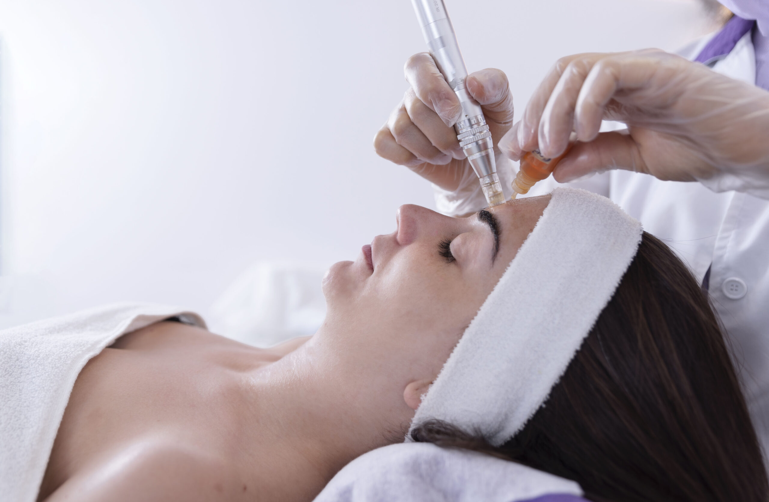Microneedling Médico