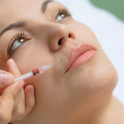 botox injection into upper lip using small syringe with thin needle