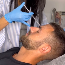 botox