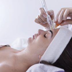 close up of Cosmetologist,beautician applying facial dermapen treatment on face of young woman customer in beauty salon.Cosmetology and professional skin care, face rejuvenation.