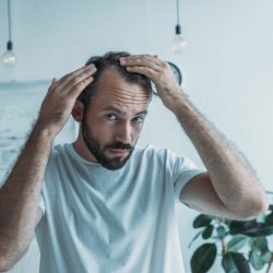 mid adult man with alopecia looking at mirror, hair loss concept