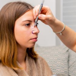 close-up plastic surgeon makes marks on a patient's face during a consultation before nose operation